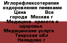 Иглорефлексотерапия, оздоровление пиявками › Цена ­ 3 000 - Все города, Москва г. Медицина, красота и здоровье » Медицинские услуги   . Тверская обл.,Нелидово г.